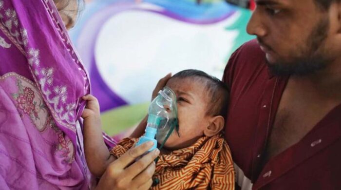 Measles OU3uSVz 1024x576 1