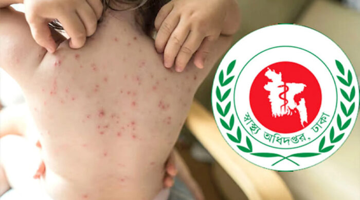Health 20260413174216